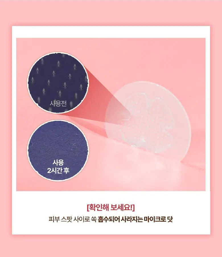 [맞춤형집중패치] 케어플러스 마이크로 닷 패치 3종 [징크트러블/글루타치온미백/레티날모공] 연합 상세페이지 11